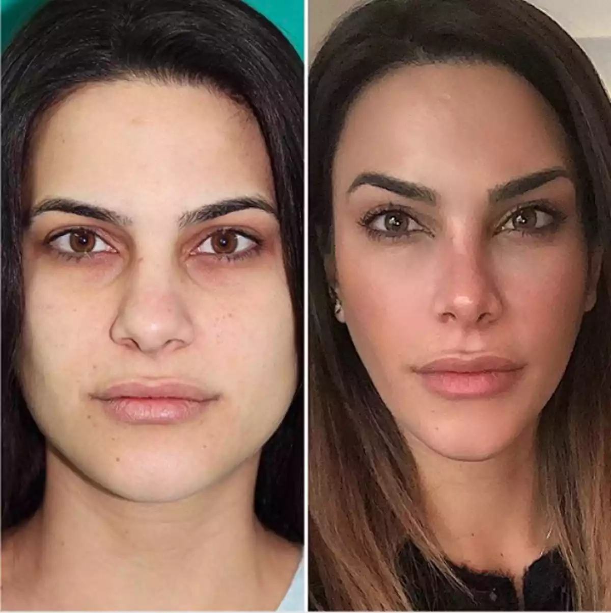 El antes y después de Carla Barber
