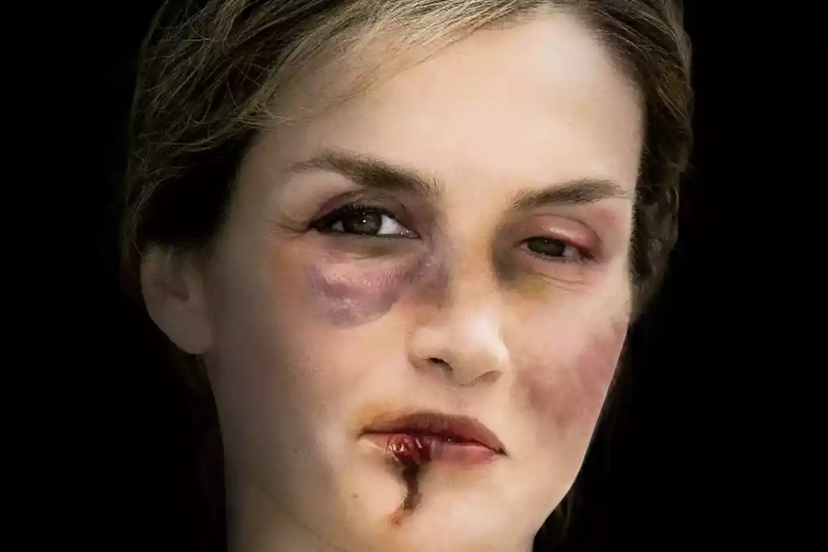 Imagen de un cartel del a reina Letizia con la cara magullada para una exposición contra la violencia de género