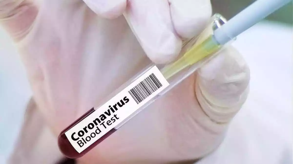 Test de sang de coronavirus